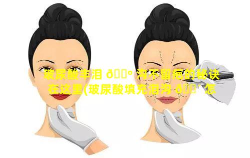 玻尿酸丰泪 🐺 沟不留疤的秘诀在这里(玻尿酸填充泪沟 🌴 怎么快速消肿)